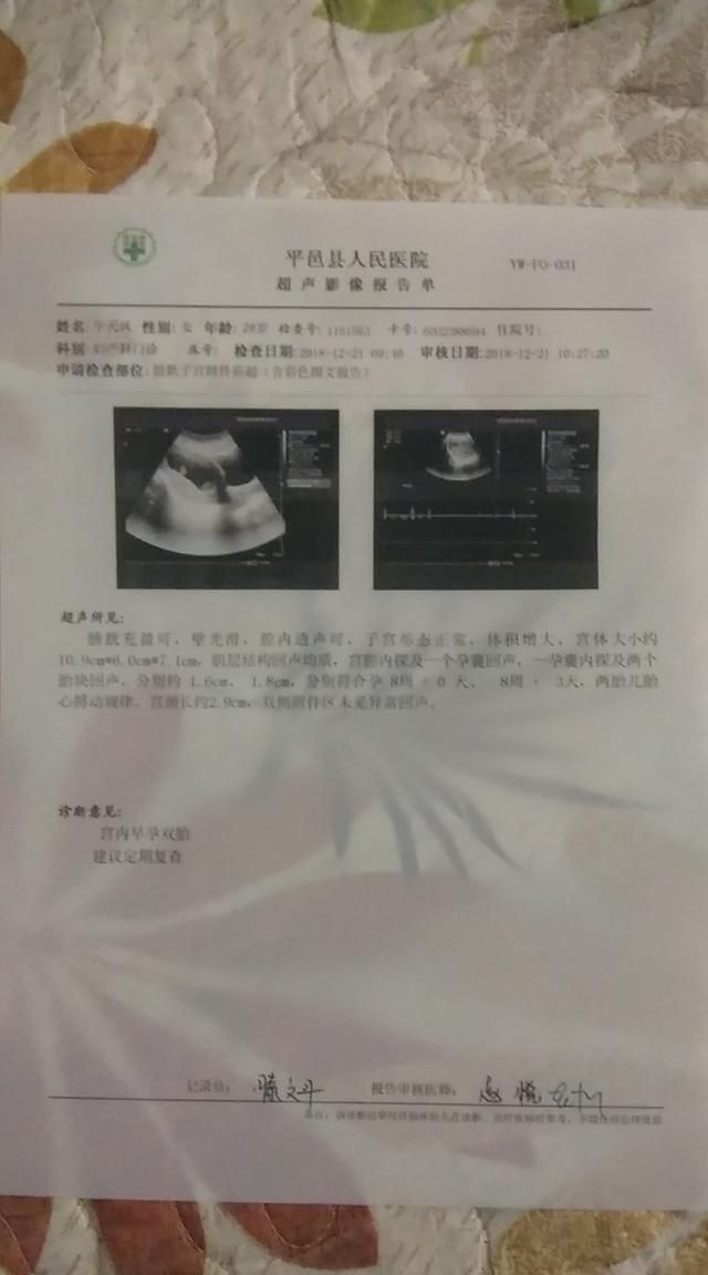 怀孕前期有什么症状，怀孕前期有什么征兆和反应图4